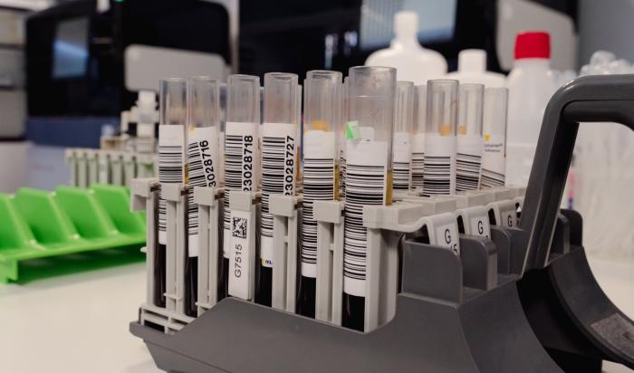 La óptima gestión de las reservas de sangre es fundamental para garantizar la demanda asistencial