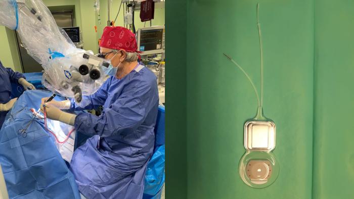Imagen un dispositivo y de una intervención desarrollada por el equipo del Servicio de Otorrinolaringología del Hospital Clínico Universitario Lozano Blesa.
