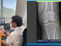 Profesional sanitario revisa estudios radiológicos mediante herramientas de apoyo basadas en inteligencia artificial implantadas en la red hospitalaria pública aragonesa.