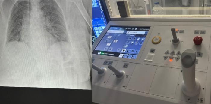 Imagen radiográfica junto al panel de control utilizado por los profesionales para ajustar y supervisar la emisión de rayos X durante la prueba.