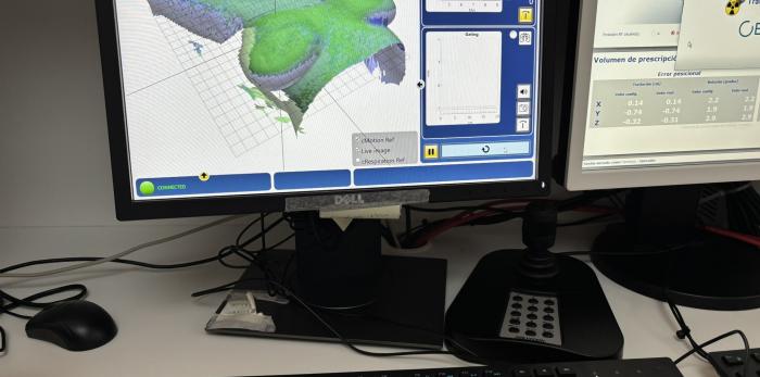 Sistema de planificación en radioterapia que permite calcular y ajustar la distribución de la dosis de radiación sobre el tumor.