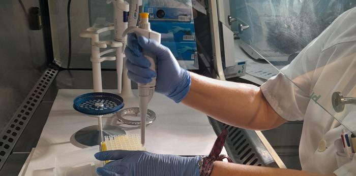 Parte del proceso de trabajo de la nueva prueba para seguimiento de los pacientes tras un cáncer de vejiga