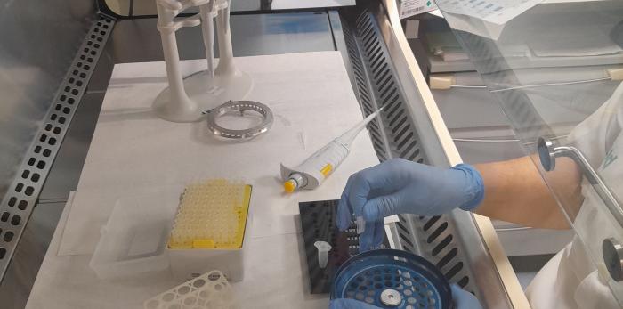 Parte del proceso de trabajo de la nueva prueba para seguimiento de los pacientes tras un cáncer de vejiga