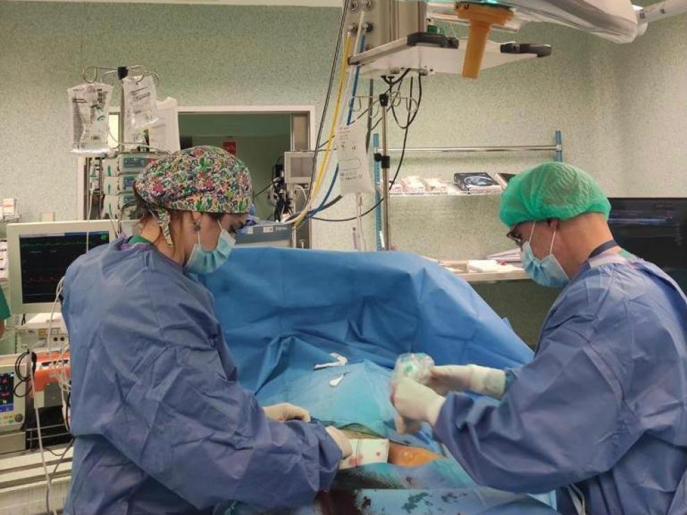 Especialistas de los hospitales Clínico y Servet realizan el primer trasplante hepático en Aragón por donación en asistolia con apoyo de ECMO