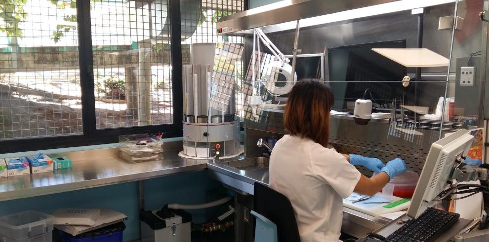 El Hospital Clínico Universitario moderniza su laboratorio de Anatomía Patológica, que ya está libre de formol 