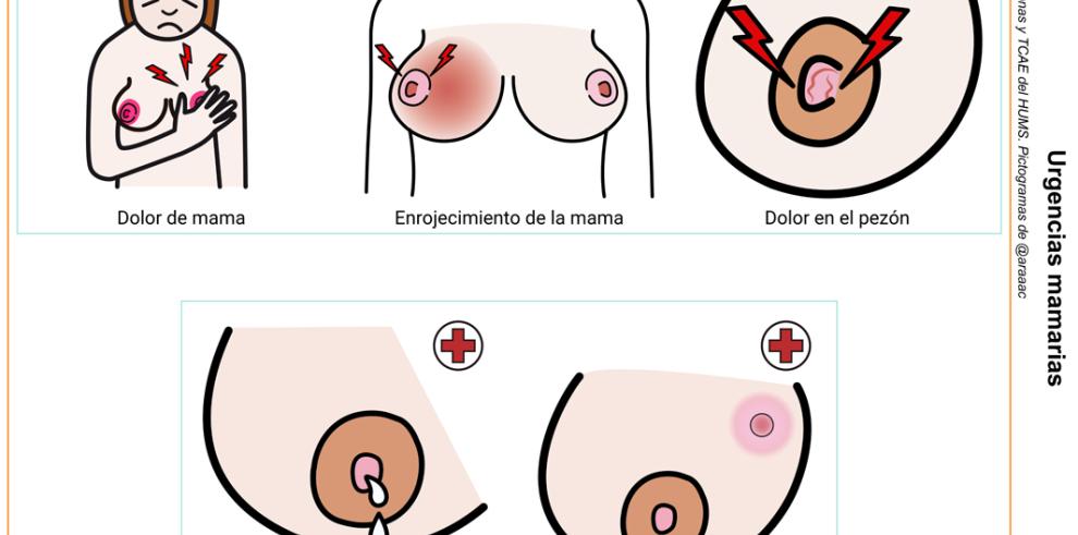 El Hospital Miguel Servet edita cuadernos con pictogramas para saltar la barrera idiomática en la atención obstétrica a la mujer